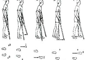 尊龙凯时医师教您脊髓损伤步态训练